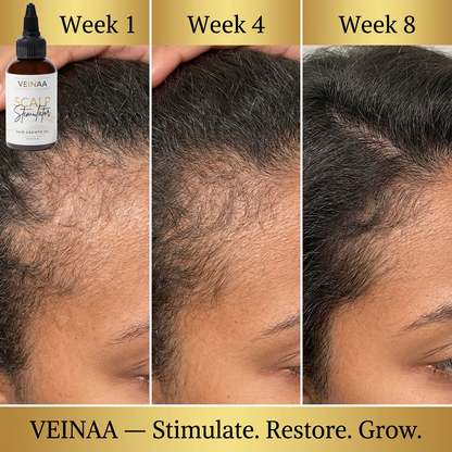 Scalp Stimulator | Hair Growth Oil