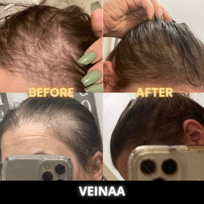 Scalp Stimulator | Hair Growth Oil